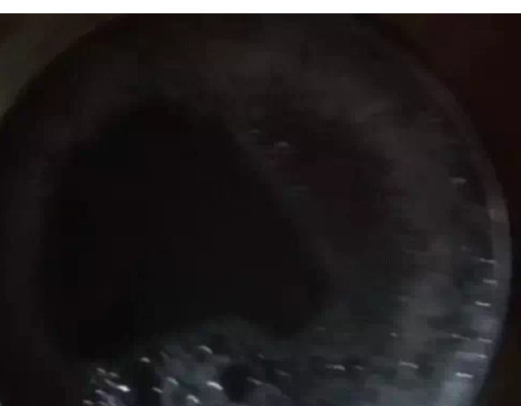 भोपाल के गायत्री नगर में गंदे पानी की सप्लाई:रहवासियों ने अफसरों को दिखाया VIDEO; शुरुआती 10 मिनट आ रहा काला पानी